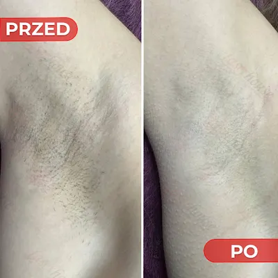 Laserhouse - Centrum depilacji laserowej i kosmetologii